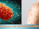 মাঙ্কিপক্স বা Mpox